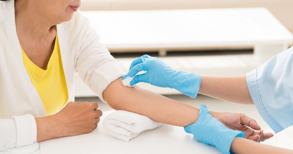 Calcolo rischio colesterolo: come controllarlo per la tua salute cardiovascolare